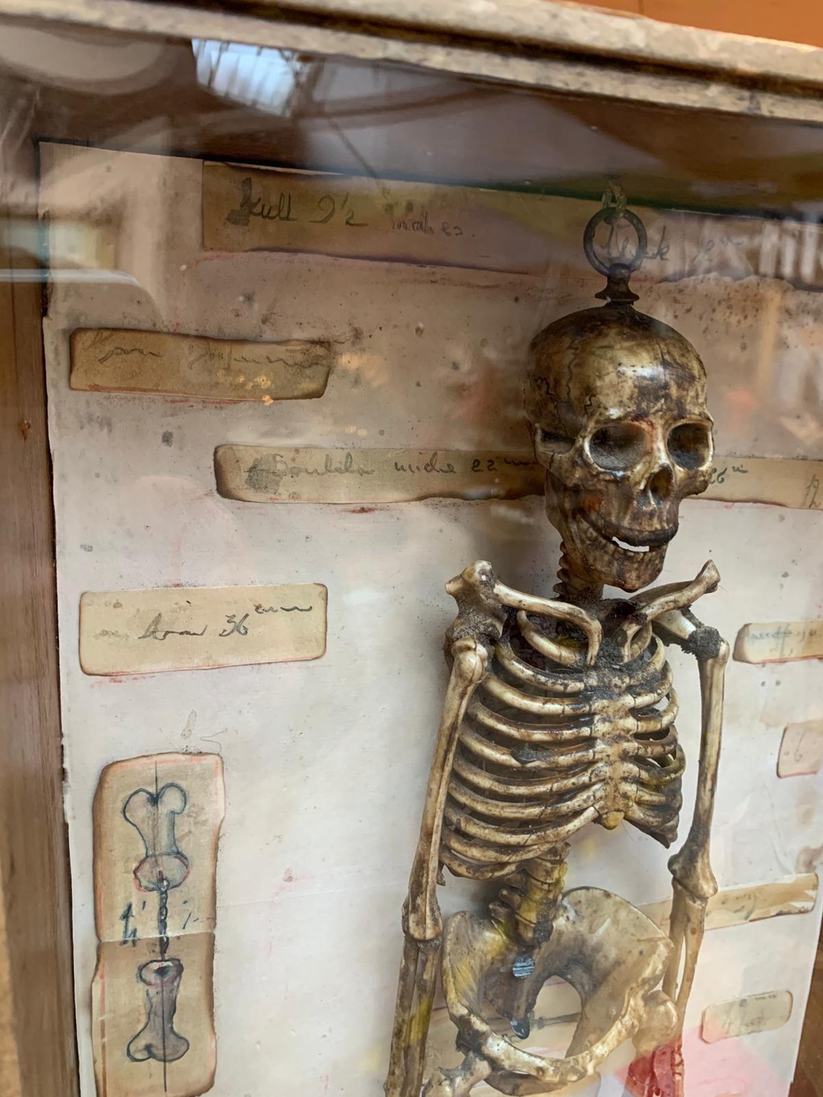 Antique model of a skeleton in case