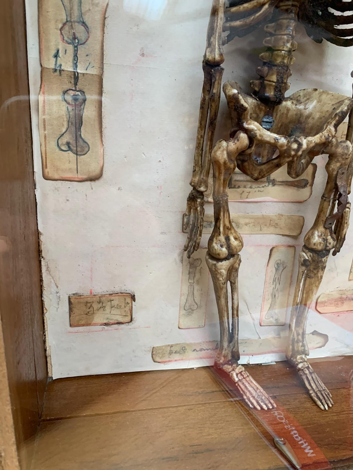 Antique model of a skeleton in case