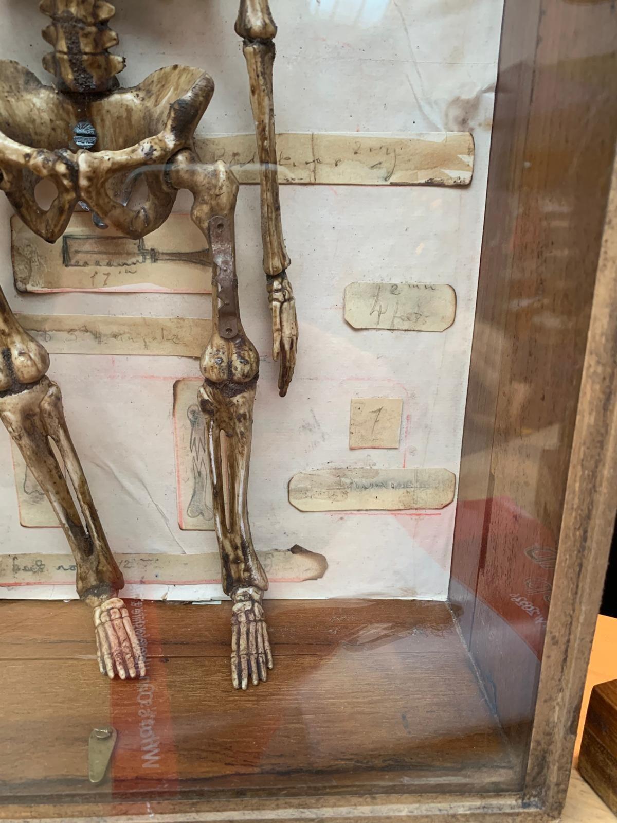 Antique model of a skeleton in case