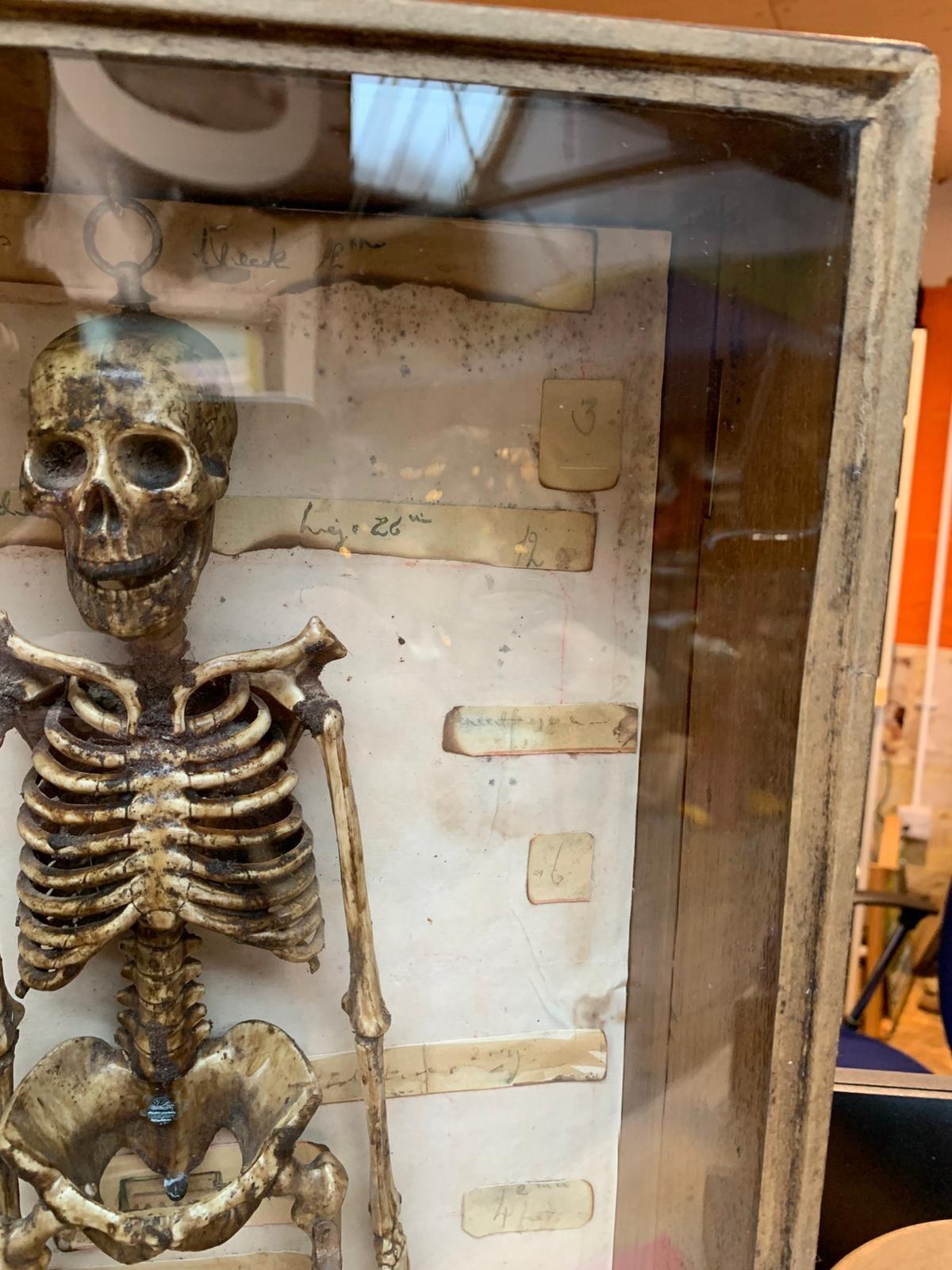 Antique model of a skeleton in case