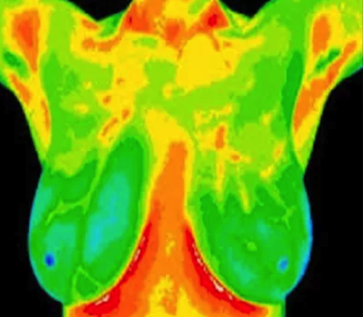 A Woman on a Mission: Meet Wendy, Certified Clinical Thermographer