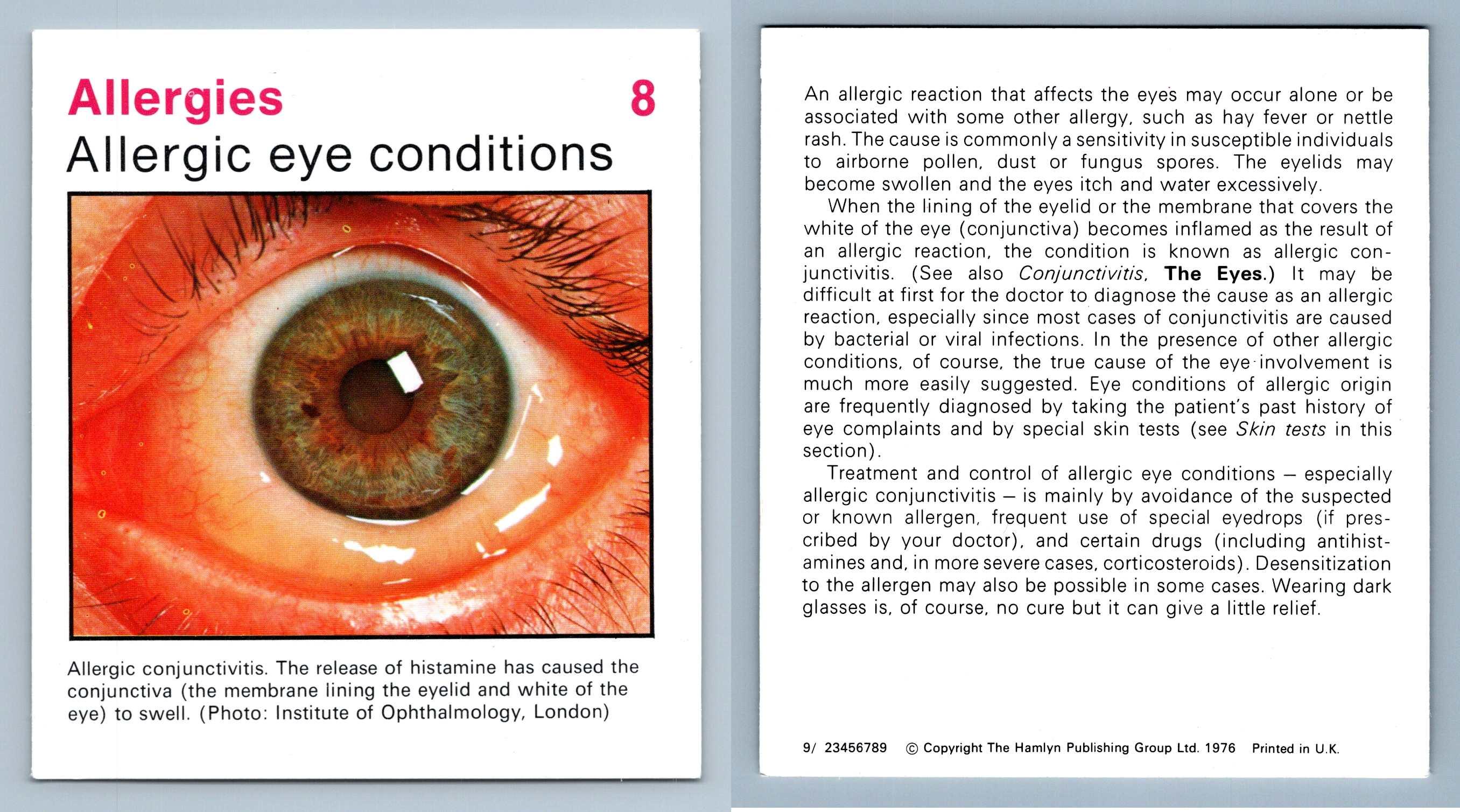 allergic-eye-conditions-8-allergies-home-medical-guide-1975-8-hamlyn