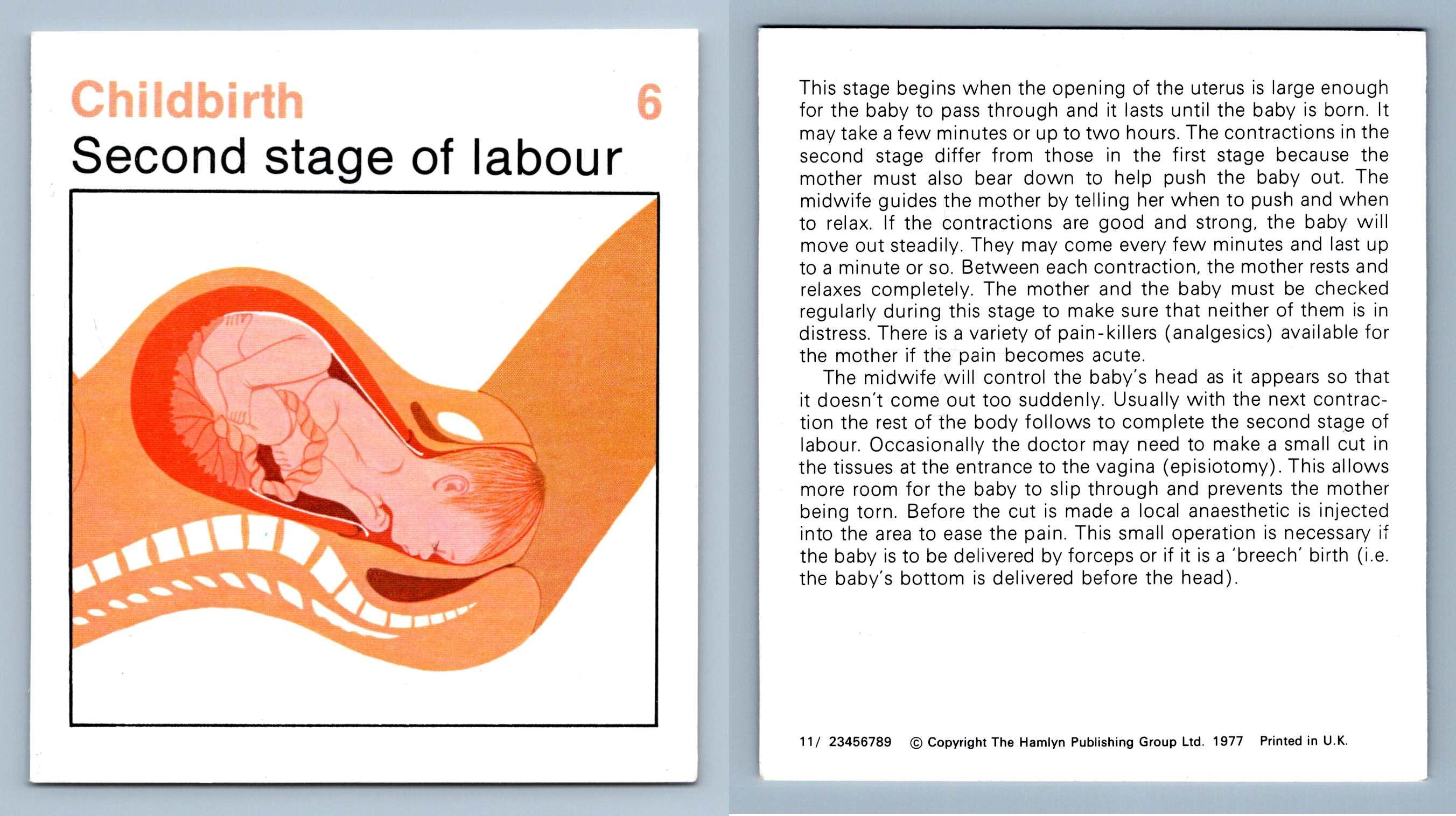 second-stage-of-labour-6-childbirth-home-medical-guide-1975-8-hamlyn