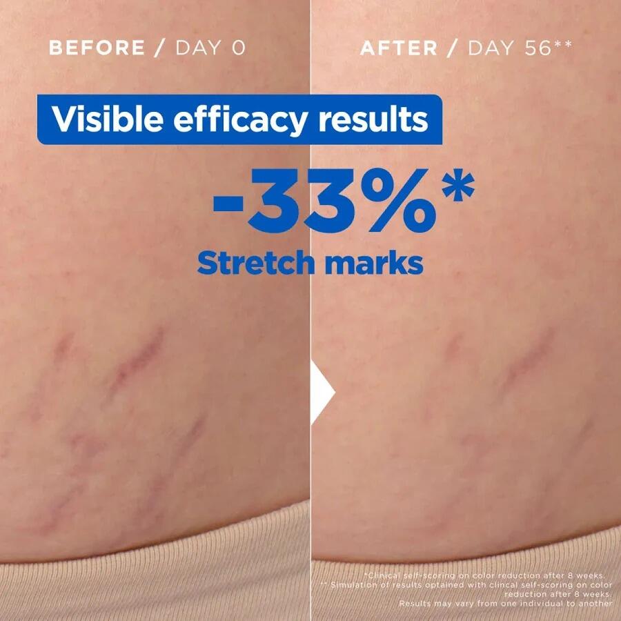 Mixa Stretch Mark Oil