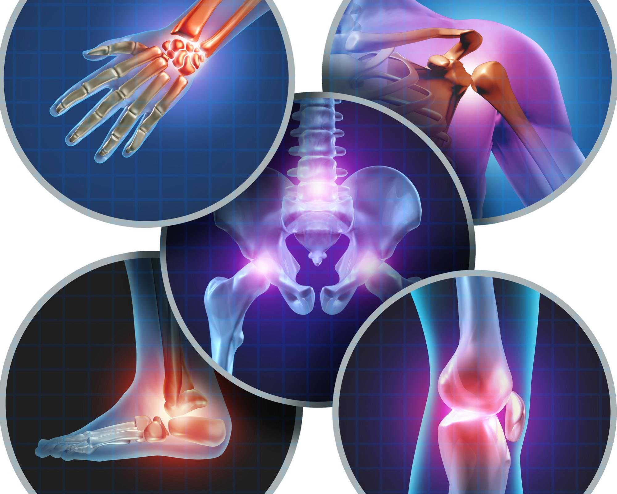  A diagram of the human skeleton with highlighted joints in blue and red, representing healthy bones and joints.