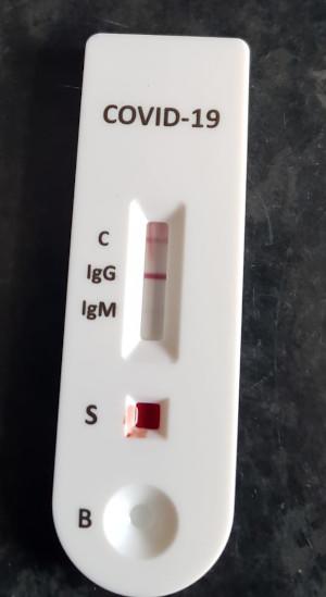 Covid-19 Surescreen Diagnostics Antibody Test Update