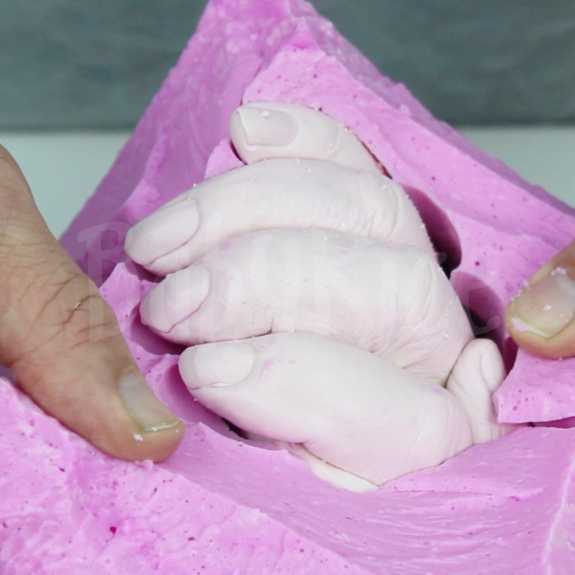 3D Impression Moulding Alginate for Hand Plaster Casting