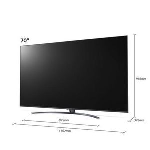 LG 70UP81006LR (2021) 70 inch HDR Smart LED 4K TV