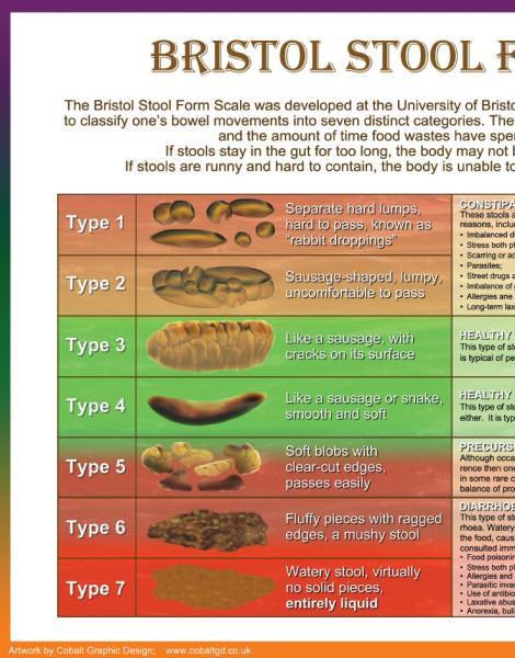 A unique visual tool, Bristol Stool Scale Poster serves as an ...