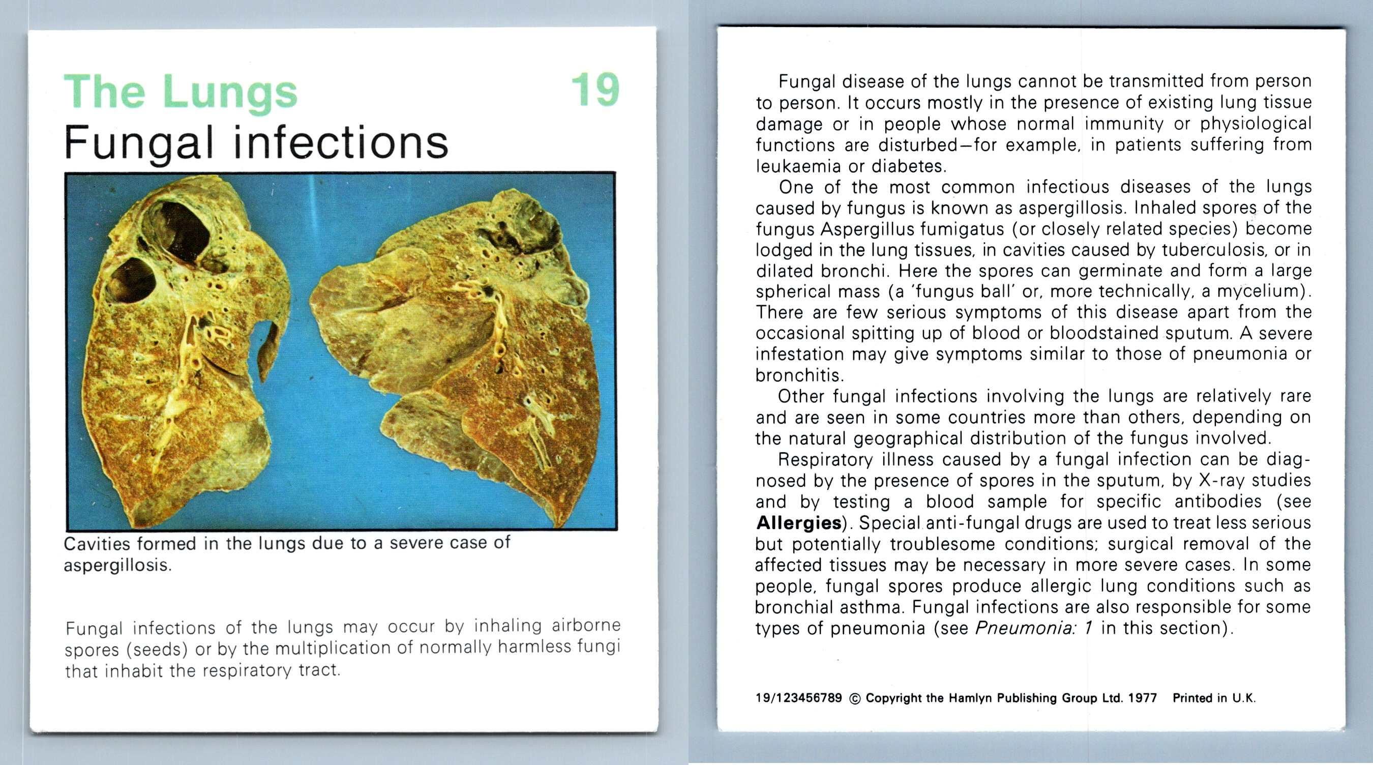 Decoding "Kal I": A Definitive Medical Guide - y4w1bow
