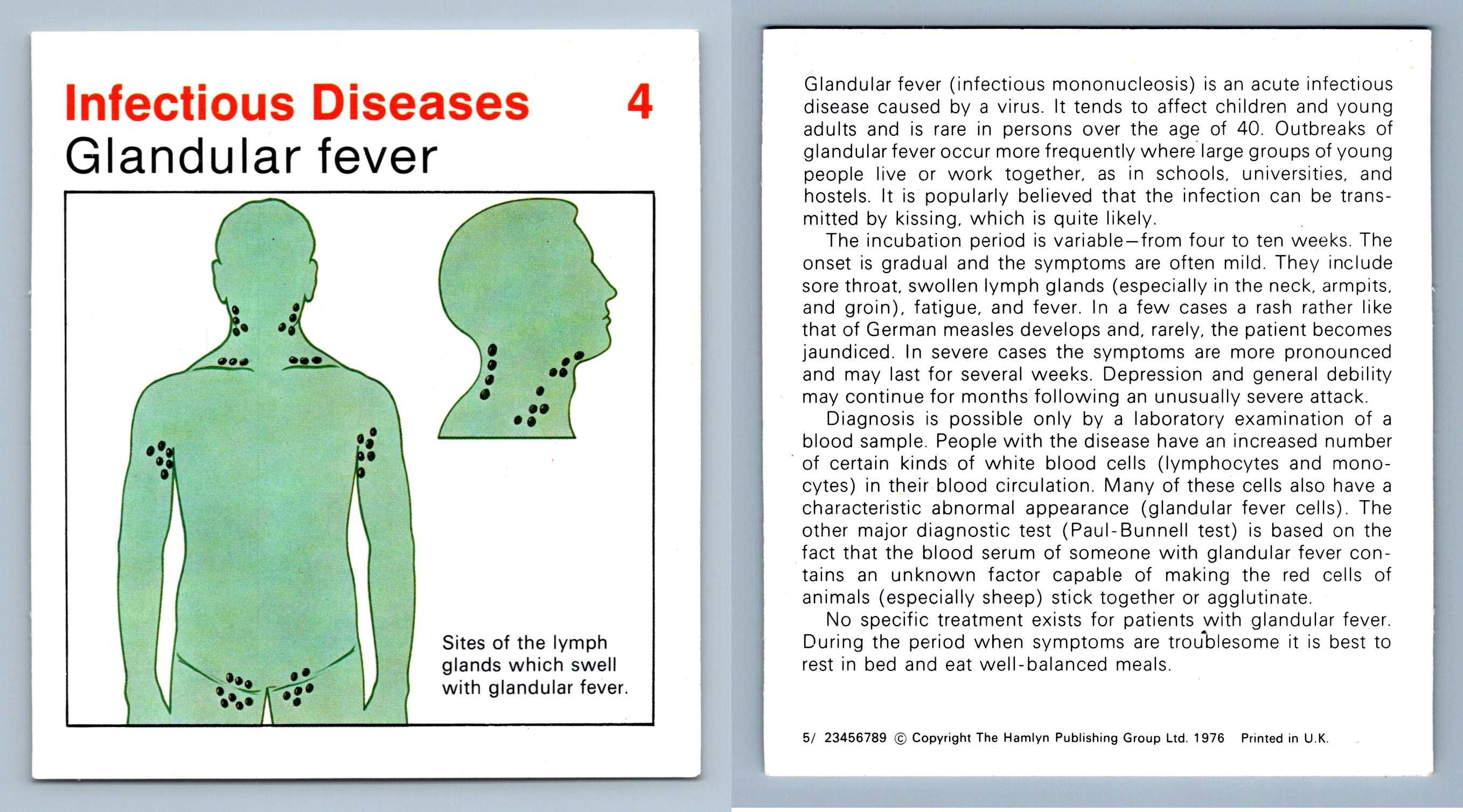 Glandular Fever 4 Infectious Home Medical Guide 19758 Hamlyn Card