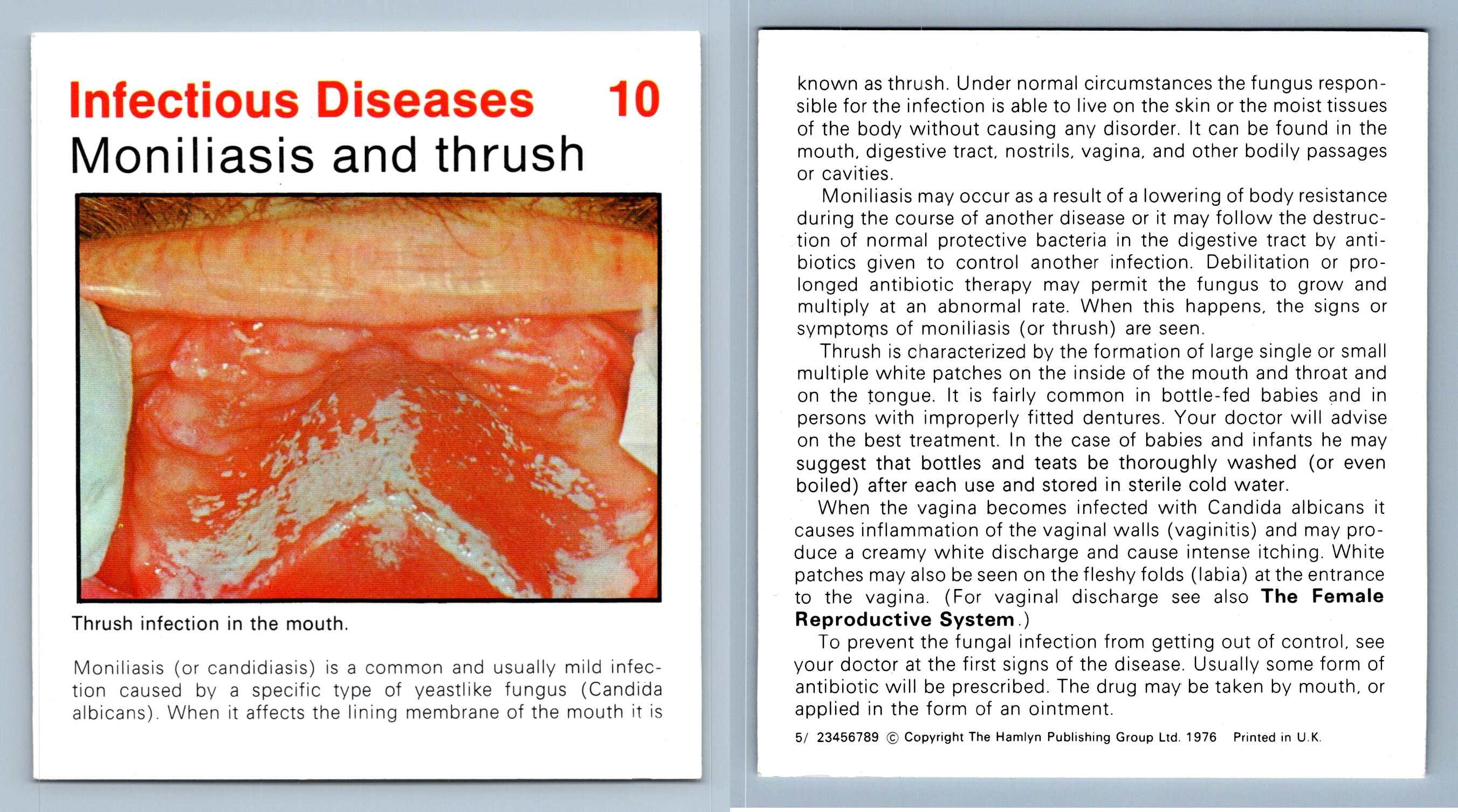 Moniliasis & Thrush #10 Infectious Home Medical Guide 1975-8 Hamlyn Card