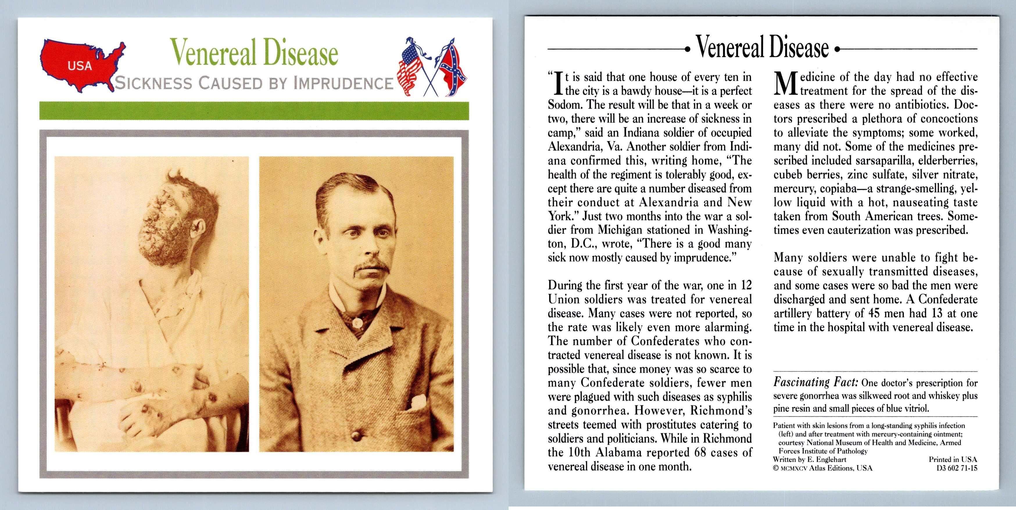 Sickness Caused By Imprudence Venereal Disease Medical Atlas Ed Civil War Card 5163