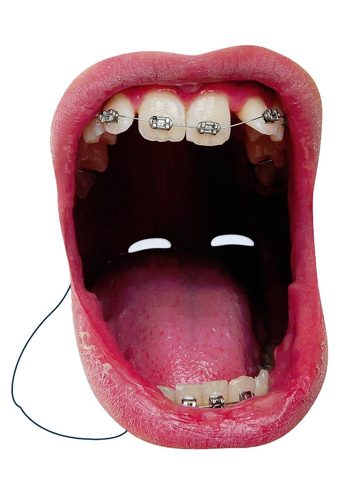 Big Mouth Braces on Teeth Facemask by Mask-erade MOUTH03 available here at Karnival Costumes online party shop