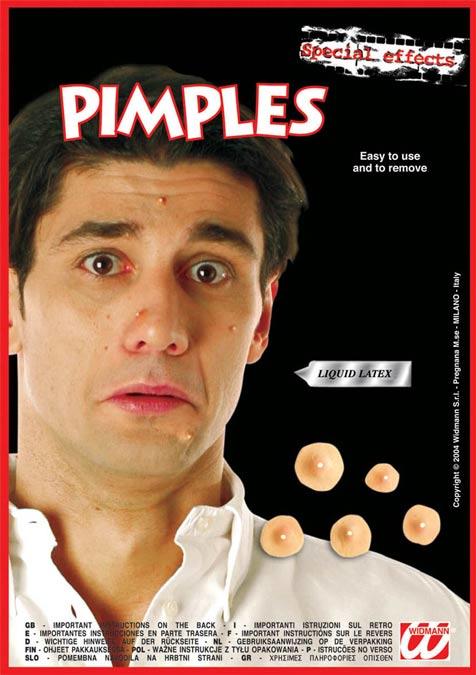 Pack of 5 Pimples with adhesive by Widmann 4134B available here at Karnival Costumeds online party shop
