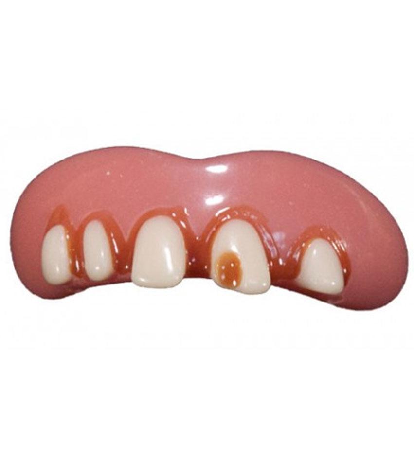 Billy Bob Teeth Original Style with Cavity 10053 available from Karnival Costumes