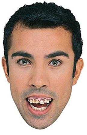 Bejewelled Teeth