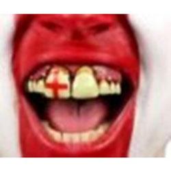 Billy Bob England Supporters Teeth item: 101537 from Karnival Costumes online party shop