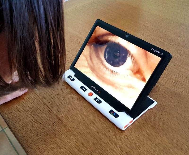 A lady using the Clover 10 self view to look at her eye
