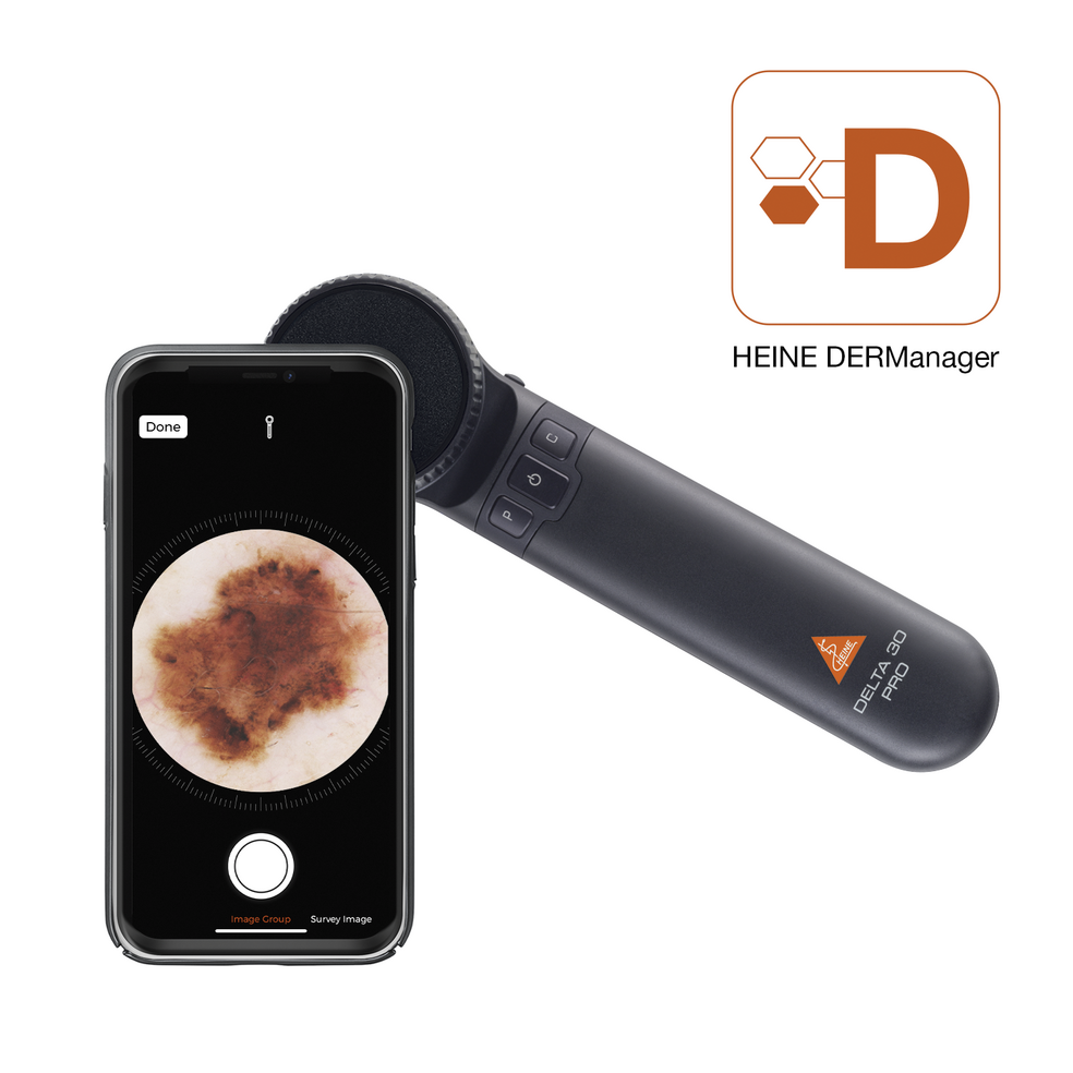 HEINE DELTA 30 PRO