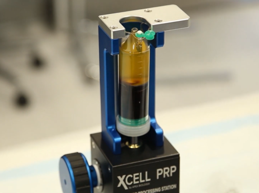 Benchtop Processing System with PRP
