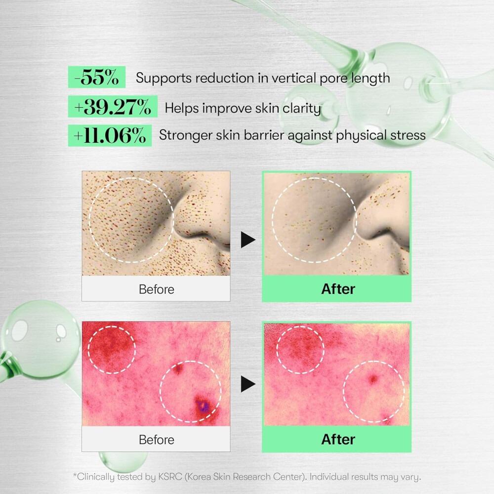 Cica Hyalon Routine VT Cica x Hyalon Reedle Shot 100 Face Serum - 50ml