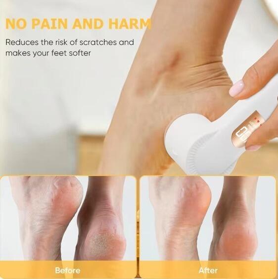Hard Skin Remover