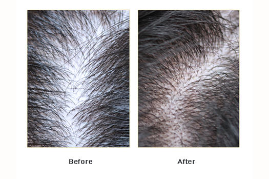 hair and scalp tonic before after