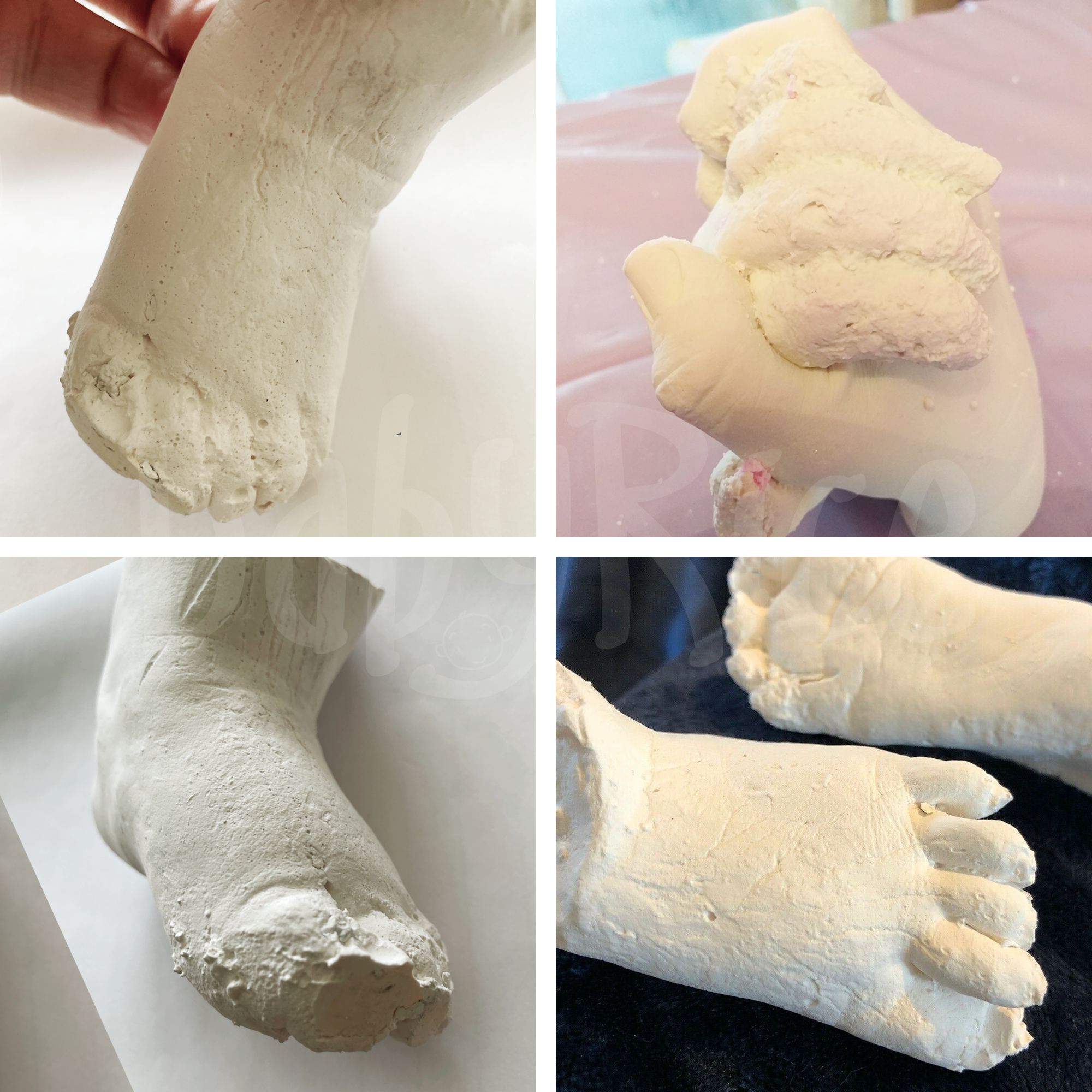 Movement in the alginate impression mould stops the alginate from replicating a perfect impression