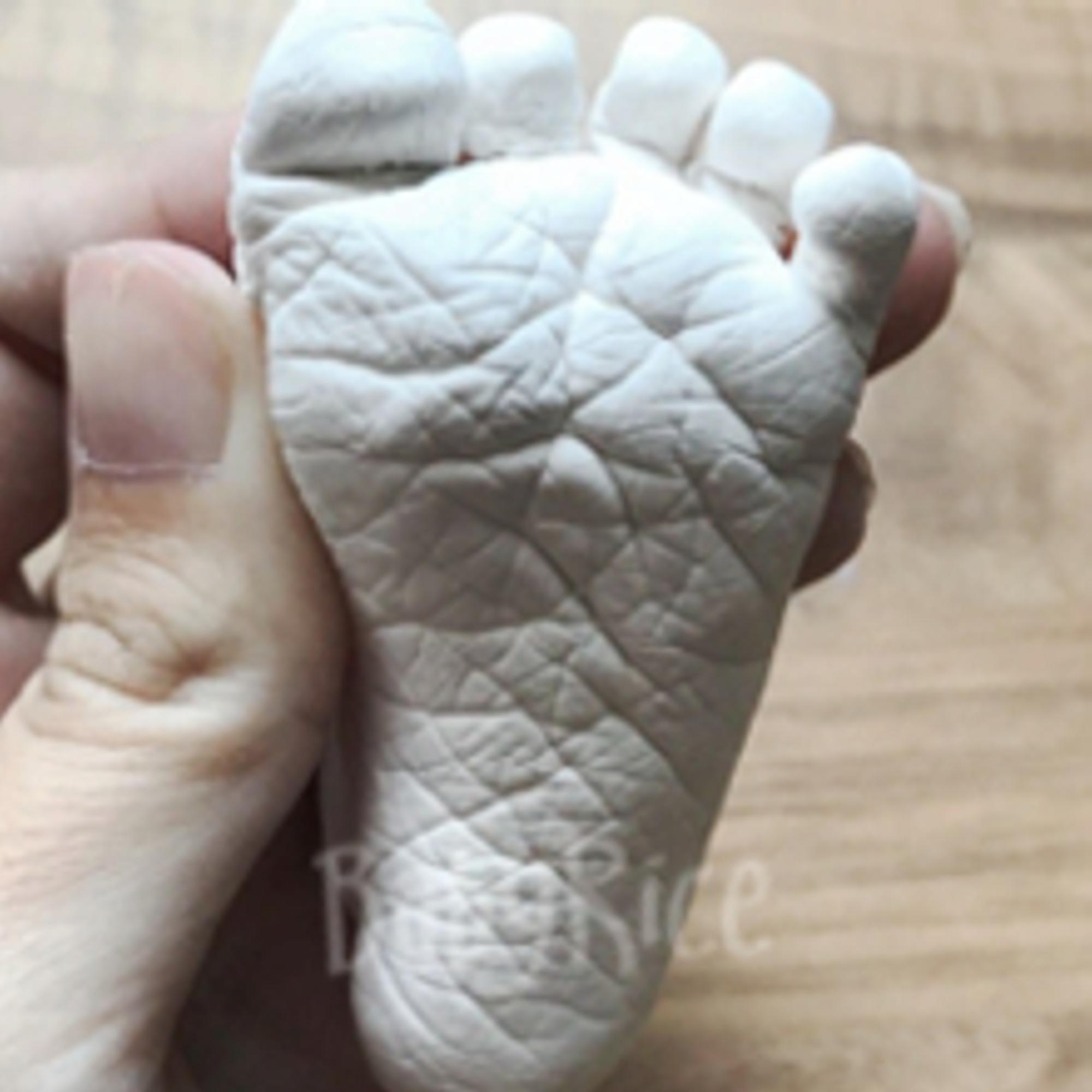 3D Foot Cast Plaster Herculite 2