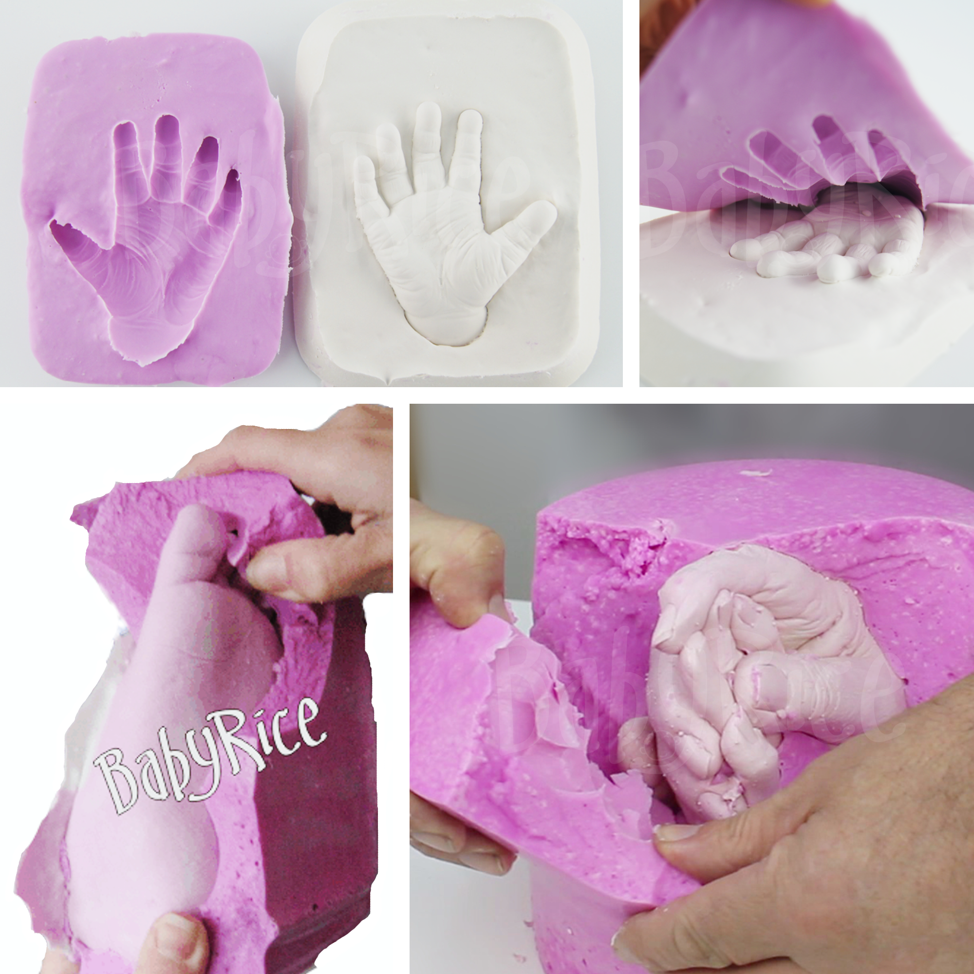 Removing alginate impression mould from plaster cast