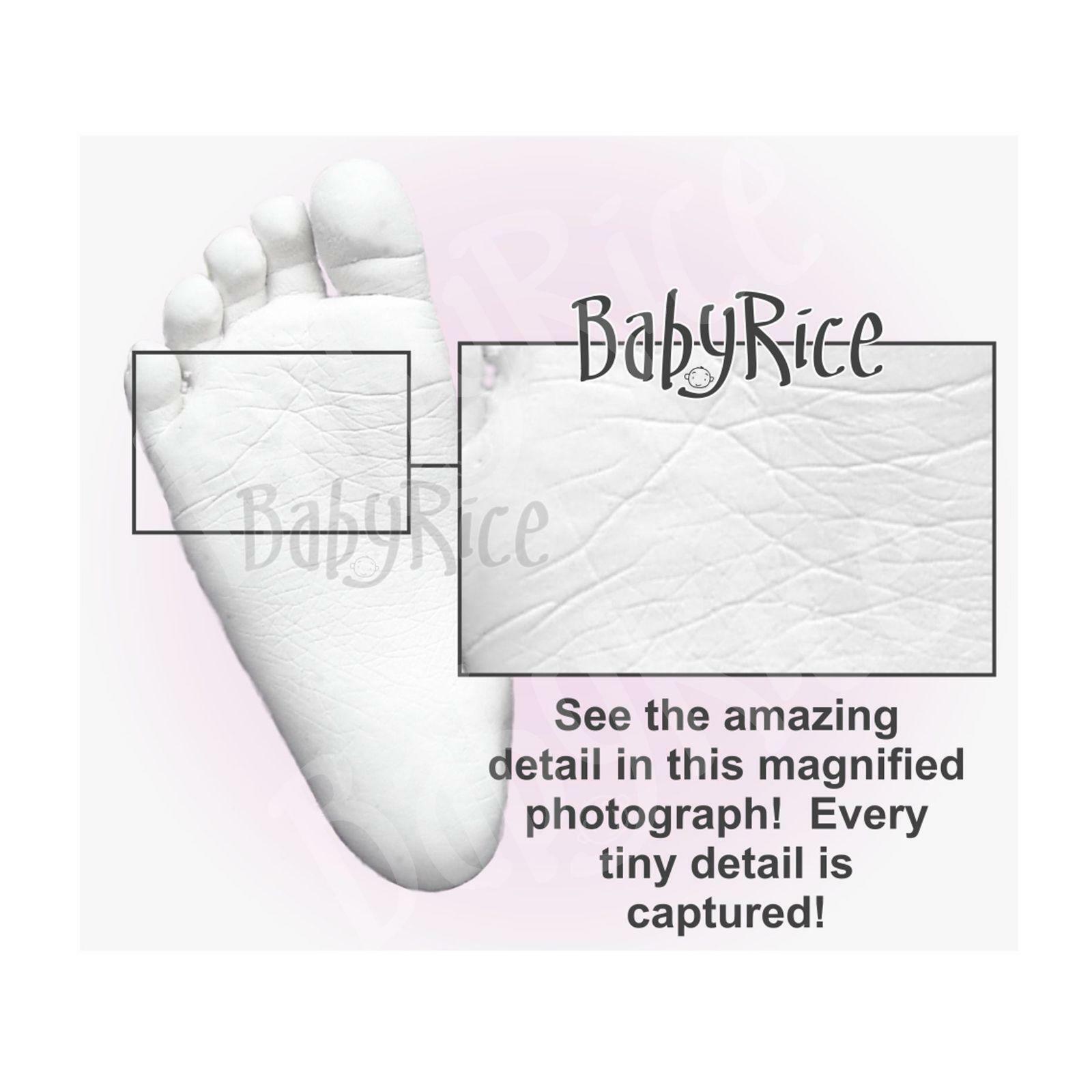 Intricate wrinkle skin details of foot plaster cast