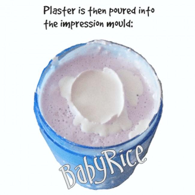 Leave Plaster Cast in Alginate to Set